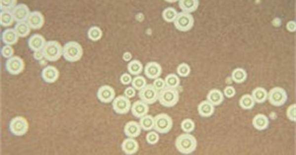 Ảnh 1 của Nhiễm nấm Cryptococcus